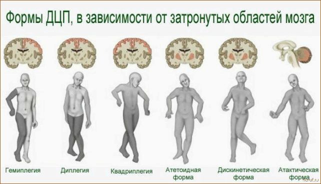 (формы детского дизайна, детский дизайн часов, дизайн детских вещей) Изучаем формы детского дизайна: как создать уютную и креативную обстановку для малышей